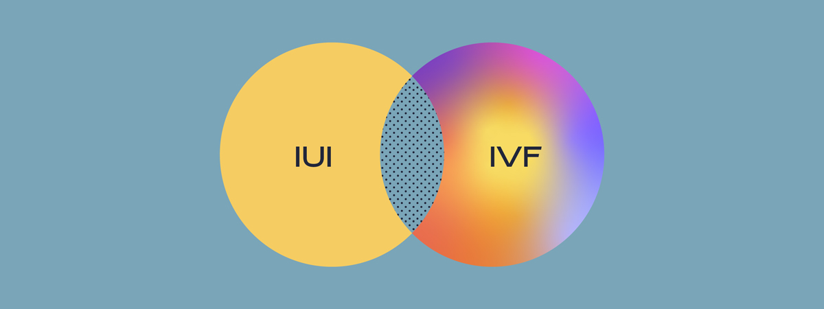 IUI vs IVF - Which Fertility Treatment is Right