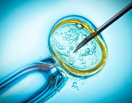 IVF Overview image