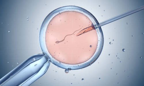 IVF